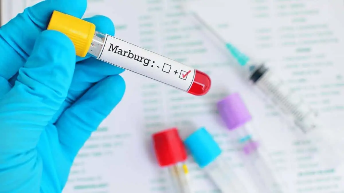 Marburg Virus